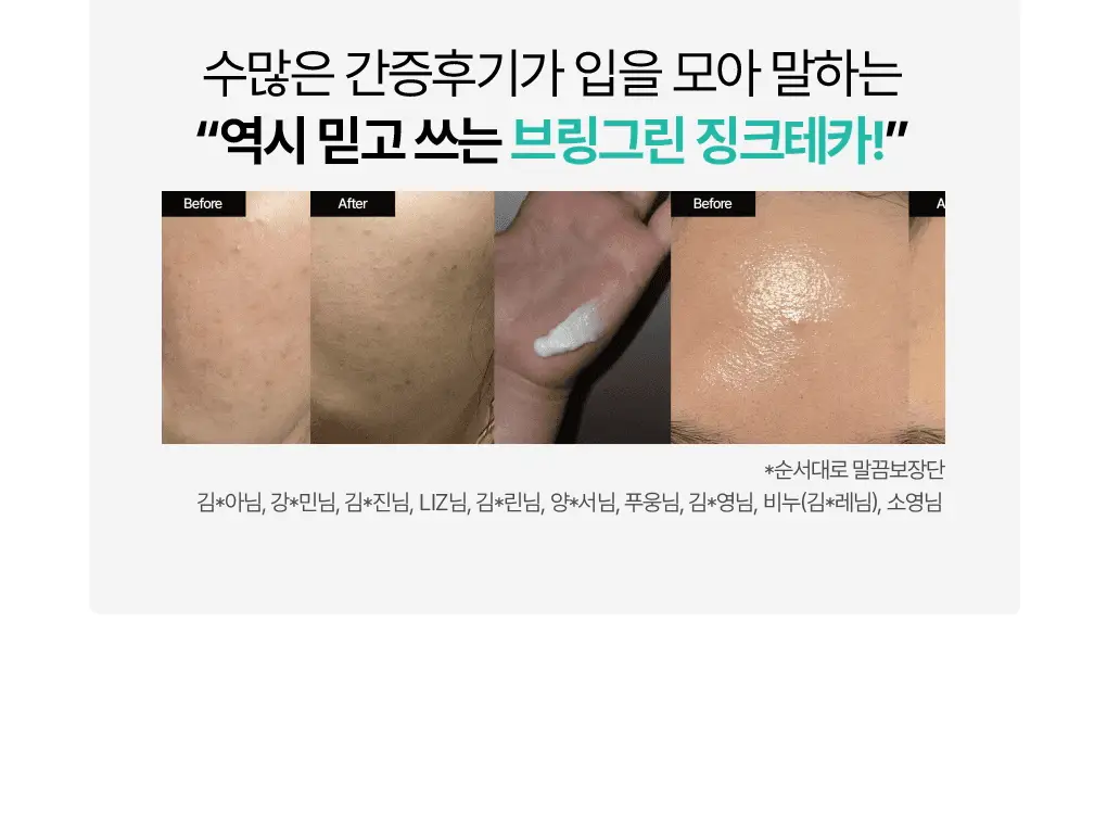 [가정의달특가] 브링그린 징크테카 리페어 흔적 크림 80ml (콜라보/기획) 상세페이지 12
